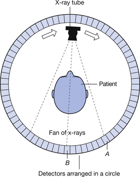 Fourth Generation CT
