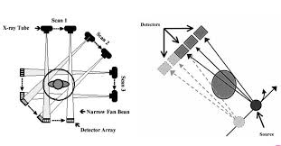 Second Generation CT