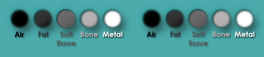 X-ray Attenuation in Tissues