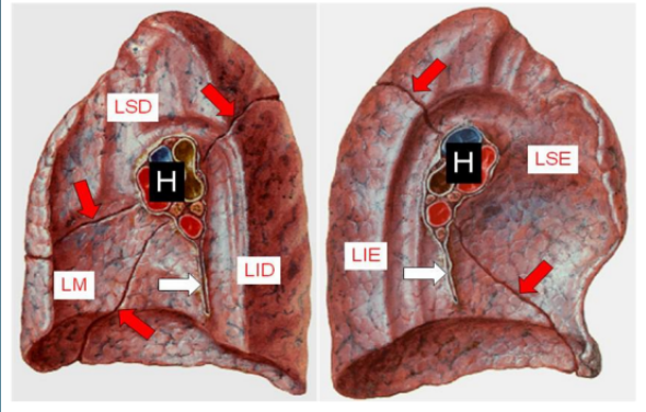 Anatomia do Tórax