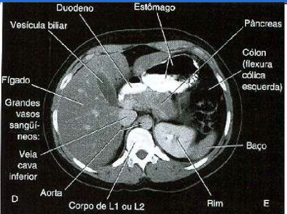 Corte axial