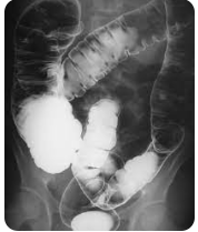 Posições no enema opaco