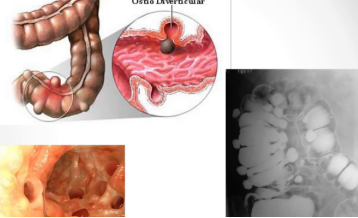 Posições no enema opaco