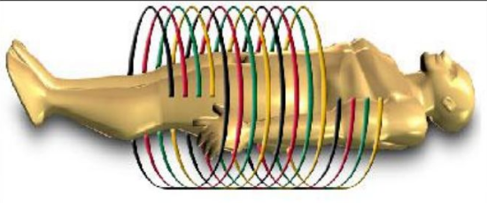 Metodos de aquisição