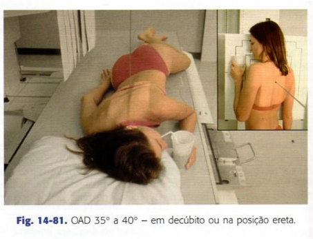 Exame contrastado de esôfago em andamento