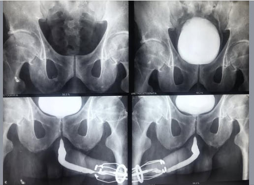 UCM Normal Masculina e Feminina